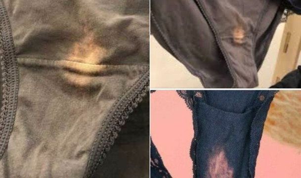 This is what it means if you find a “bleach” spot on your underwear