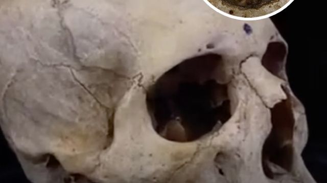 HT1.Extraordinary’ Egyptian skull shows medical attempts to treat cancer more than 4,000 years ago