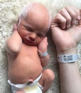 HT1.Baby mocked for having white hair – years later, he looks perfectly happy and healthy