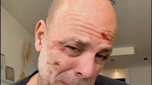 HT1. Bruce Willis' wife Emma Heming shares heartbreaking video of him after his dementia diagnosis