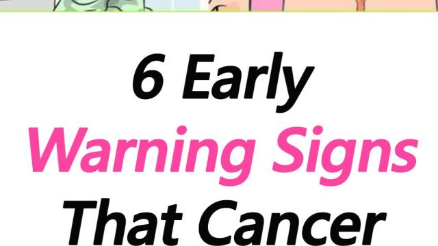 ST1. 6 Early Warning Signs That Cancer is Growing In Your Colon