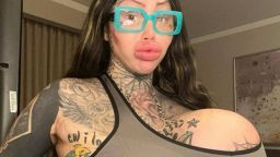 ST1. Surgery-addicted model's 38J br**st implant BURSTS leaving her with a lopsided 'alien uniboob' - as fans beg her to stop going under the knife: 'Your body is literally telling you to stop'