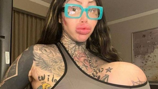 ST2. Surgery-addicted model's 38J br**st implant BURSTS leaving her with a lopsided 'alien uniboob' - as fans beg her to stop going under the knife: 'Your body is literally telling you to stop'