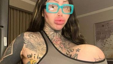 ST4. Surgery-addicted model's 38J br**st implant BURSTS leaving her with a lopsided 'alien uniboob' - as fans beg her to stop going under the knife: 'Your body is literally telling you to stop'